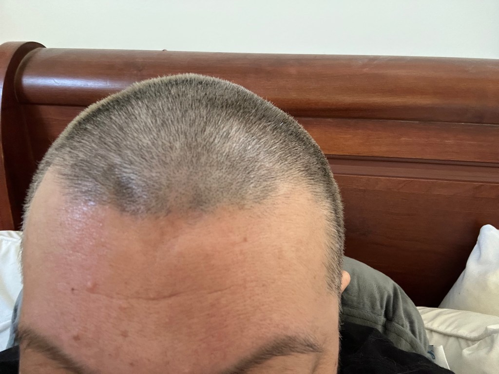 hair today, gone&nbsp;tomorrow